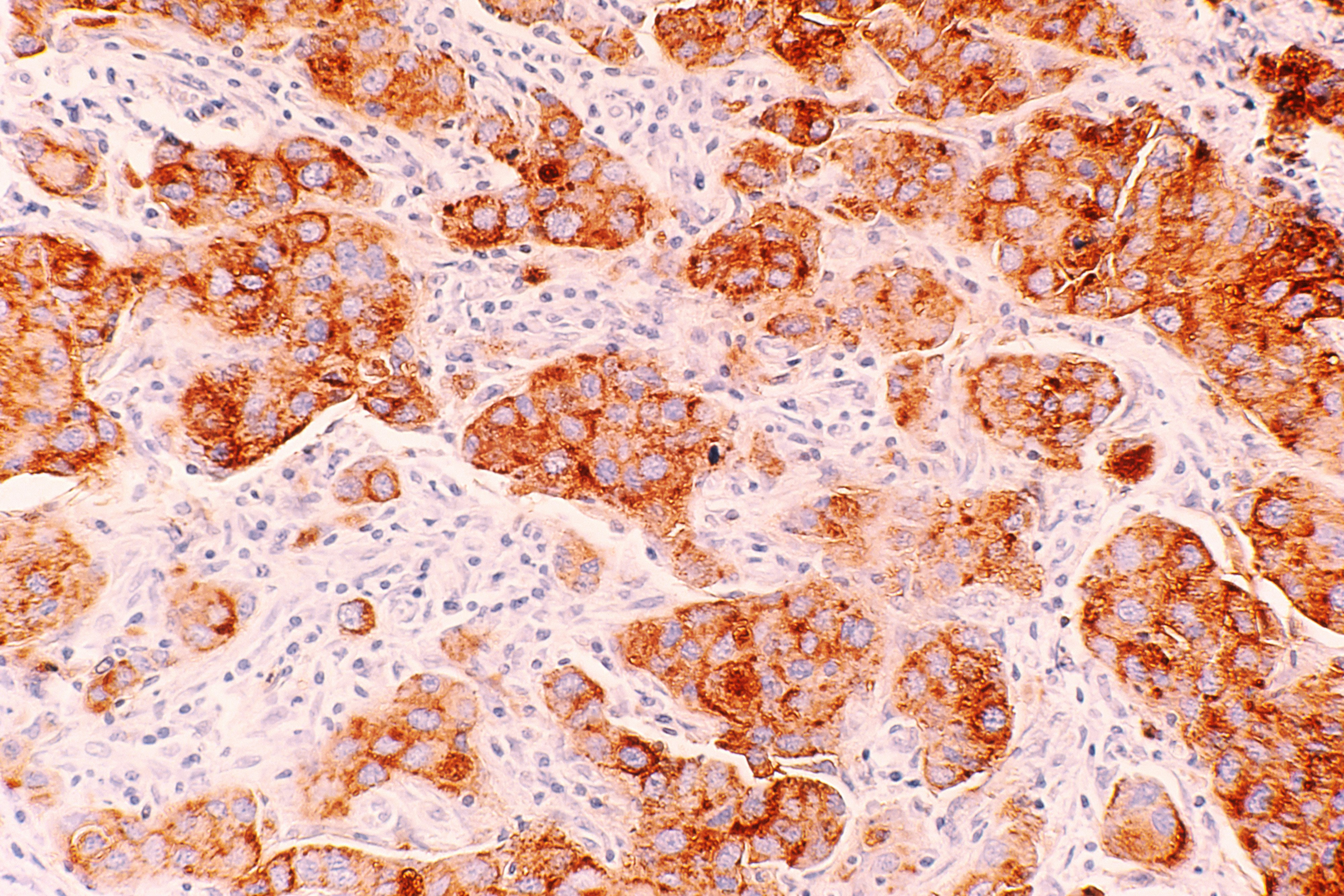 national-cancer-institute-I-F4ibaAtLA-unsplash.jpg