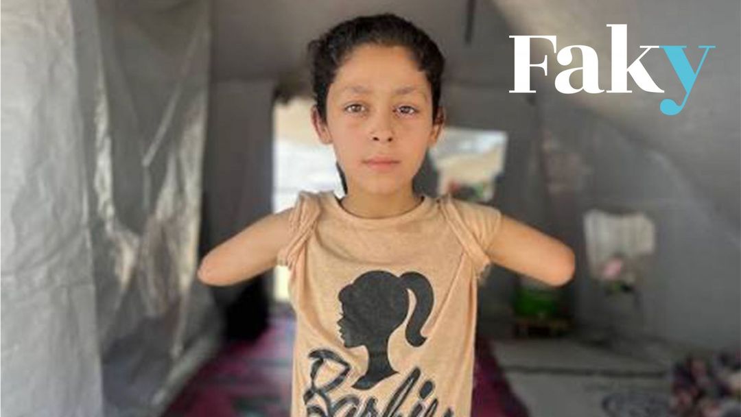 Soupçonnée d’être générée par IA, la photo de cette jeune gazaouie amputée des deux bras est bien réelle - Featured image